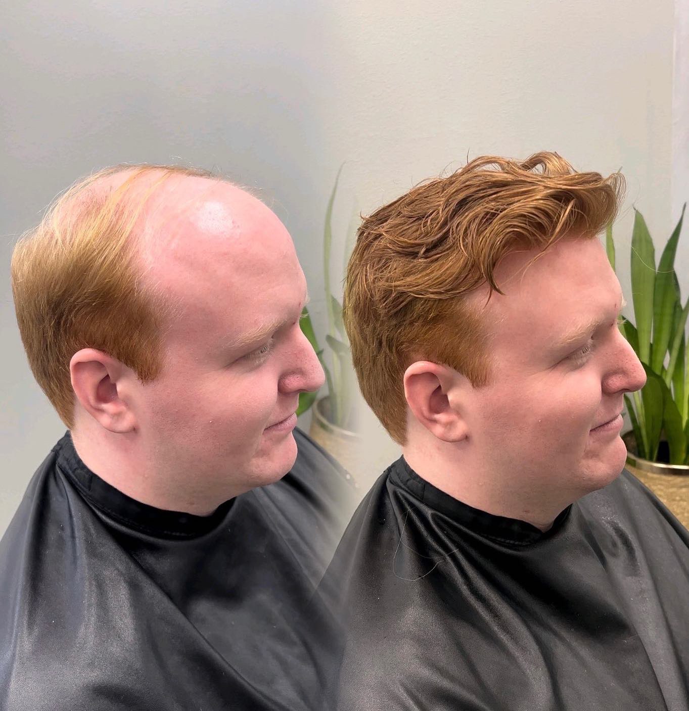 Red-haired client before-and-after custom men's hair system result