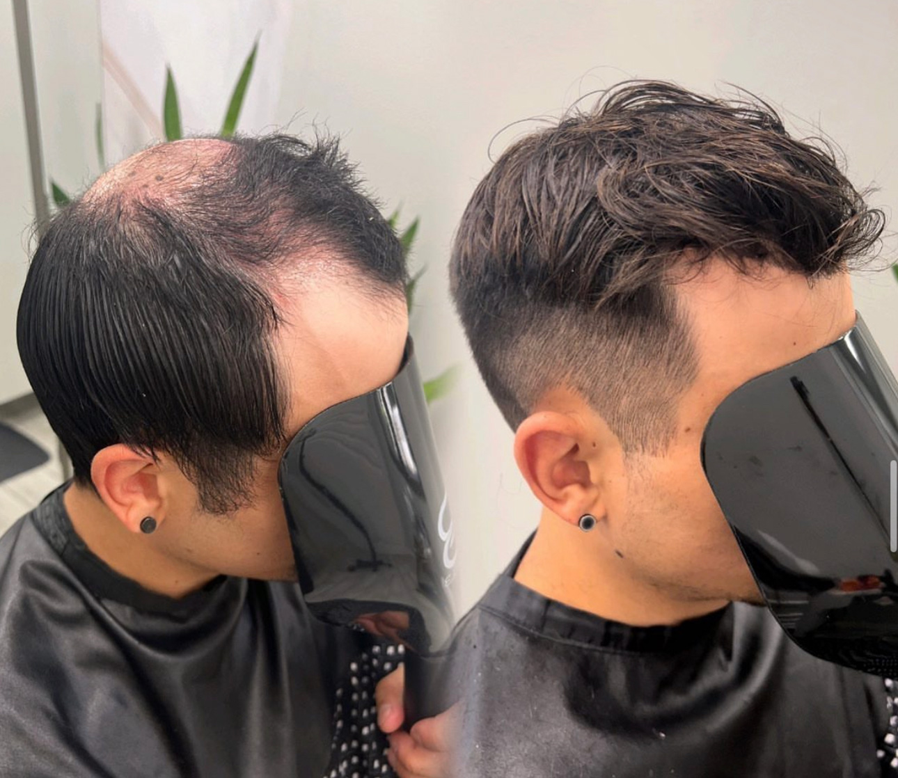 Men's hair system before-and-after result with dark styled hair in Taunton, Massachusetts