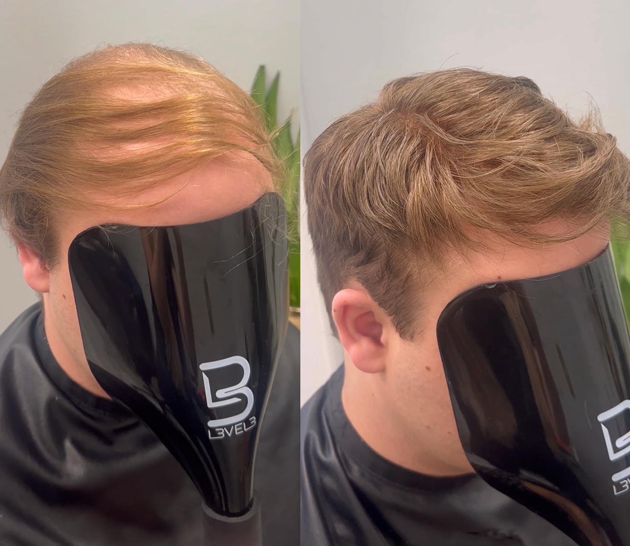 Men's hair system transformation from thinning hair to a curly style in Taunton