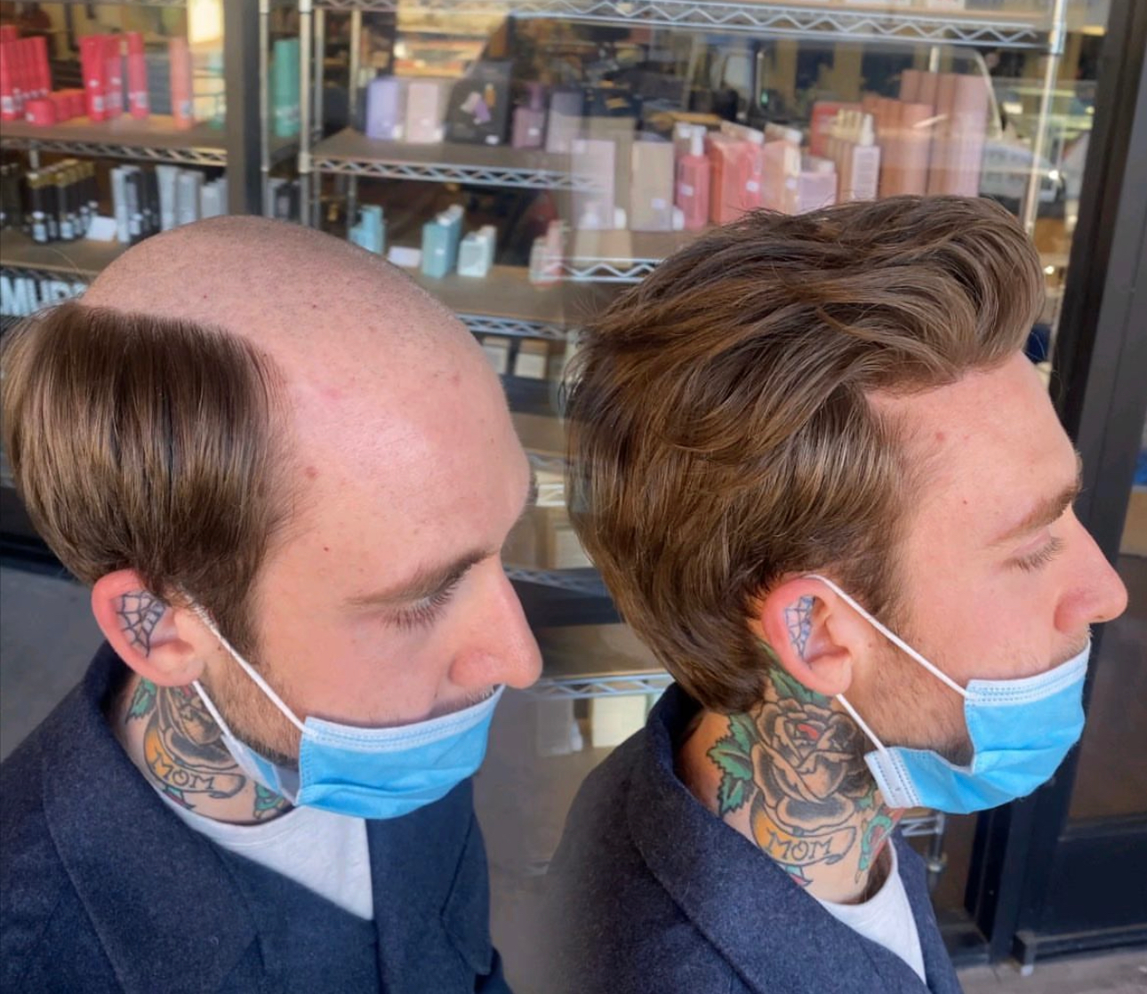 Men's hair system before-and-after result for a consultation with Monk the Guru